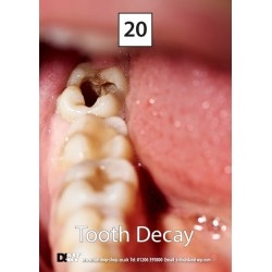 D&Wp Drug Awareness Flash Cards - Sets 1 & 2